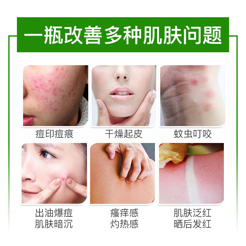 碧雅漫自然芦荟胶补水保湿清逗淡印细致毛孔晒后呵护温和不刺激男女通用 300gx2盒保湿芦荟胶