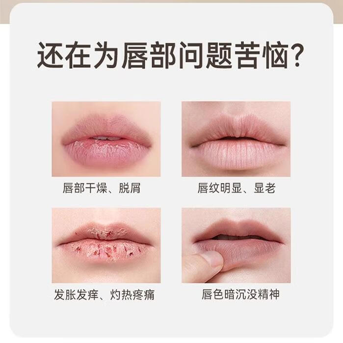 谐医堂三草油护唇啫喱润唇膏补水保湿滋润修护秋冬修护唇炎去死皮淡唇纹 5盒装（买2送3发5盒）