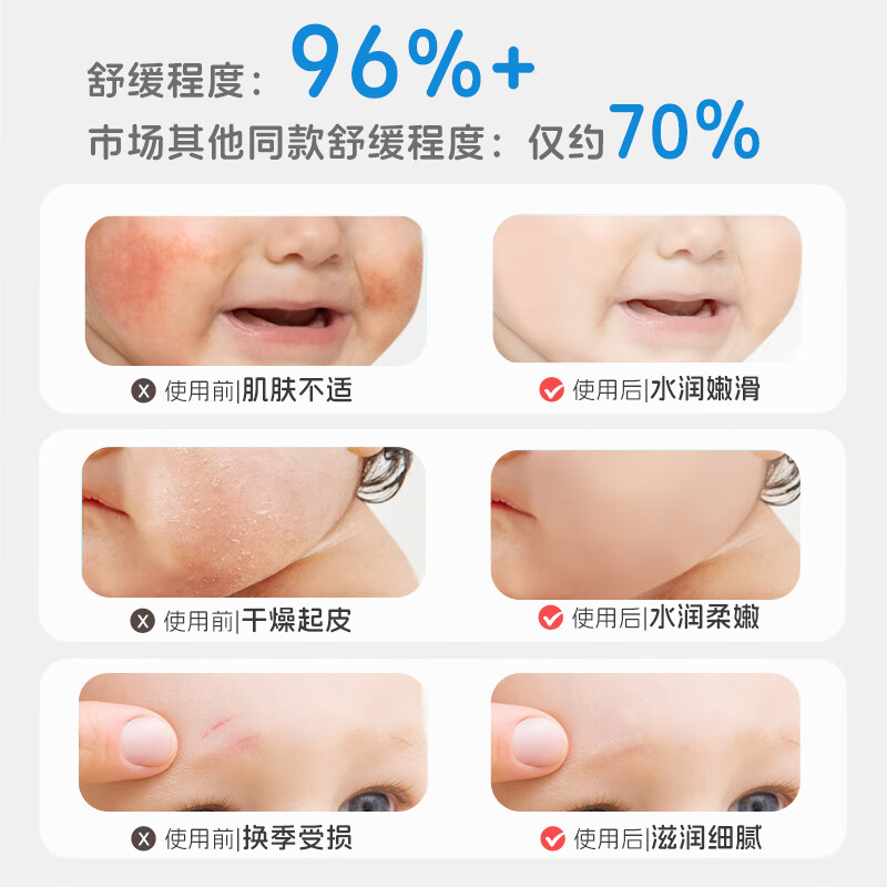 皇家婴童婴儿面霜儿童护肤品新生儿秋冬宝宝润肤乳专用保湿霜滋润补水乳 【水润呵护】金盏花面霜50gx2