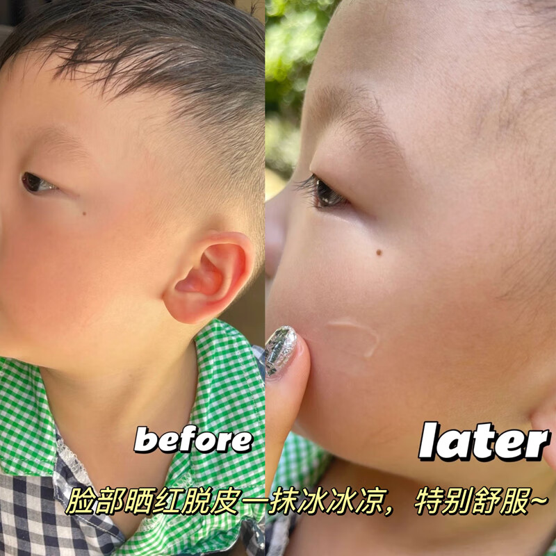 宝弘儿童晒后修复凝胶婴儿宝宝户外皮肤晒伤金盏花补水舒缓