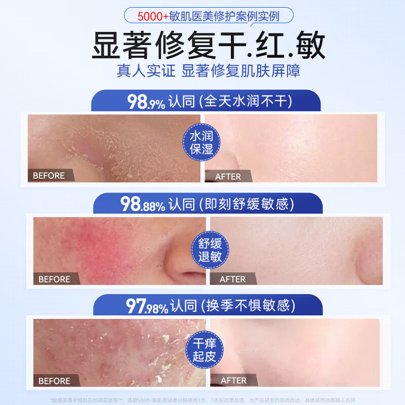 纽利安（Newliann）儿童面霜女孩高保湿滋润宝宝舒缓泛红保湿修覆新生婴儿专用修护霜 享5折【8瓶 囤货特惠装】 根源修覆敏感肌