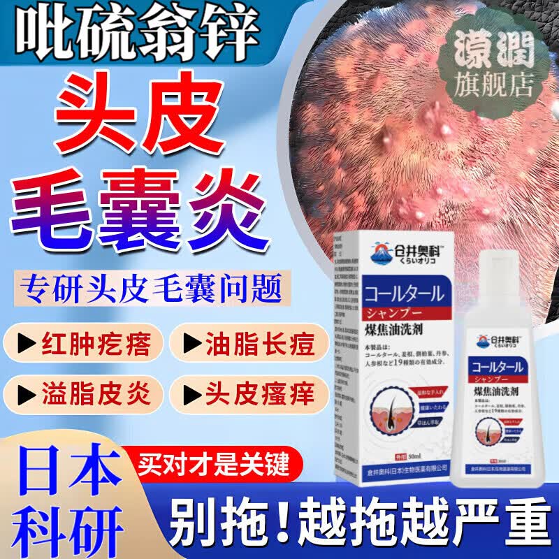 吡硫翁锌洗发水毛囊炎头皮洗剂烟焦油脂溢性红肿疙瘩去屑止痒抑菌 1