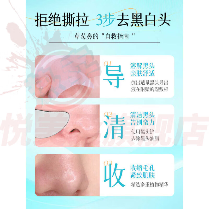 喜姿盈jsv黑头导出液精华液水美容院专用去收缩毛孔粉刺妙鼻贴官方正品 1瓶【体验装】