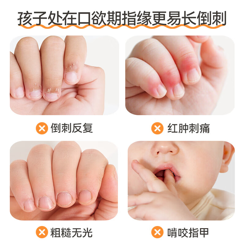 哆咪奇婴儿指缘油苦甲水润护甲缘油改善手指倒刺防啃戒吃手 绵羊油面霜*1+婴童指缘油*1【秋冬专用】