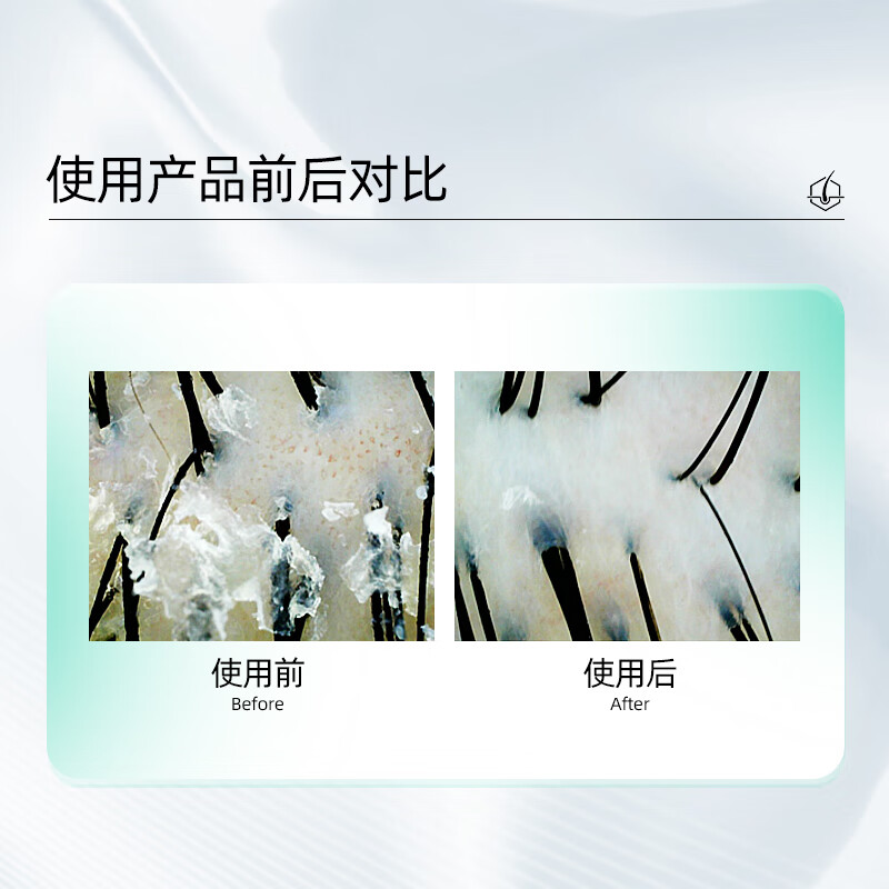 史云逊预洗素VT史云逊头皮素净爽舒缓头皮素【官方正品】 中性头皮 【新效期】舒缓头皮素VT100ml