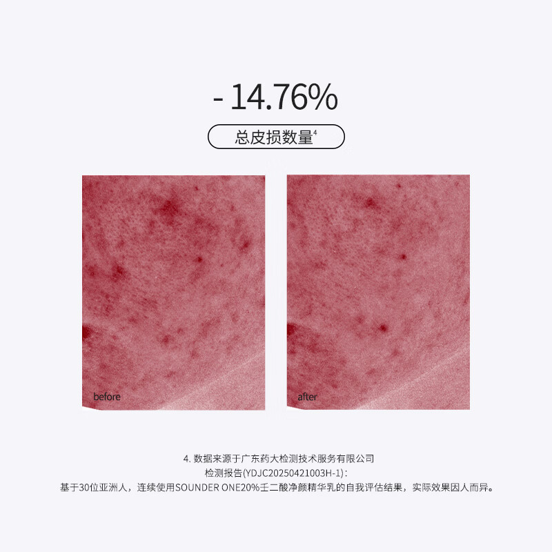 SOUNDER ONE20%壬二酸密集焕颜乳霜 控油祛痘保湿舒缓护肤品送女友
