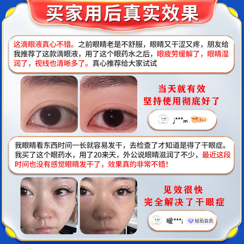 坂枝野寻日本原装进口干眼症专用眼药水缓解眼疲劳眼干眼涩胀痛视力模糊 特效一盒【国产】多买多送 老年人抗疲劳蓝莓叶黄素滴眼液