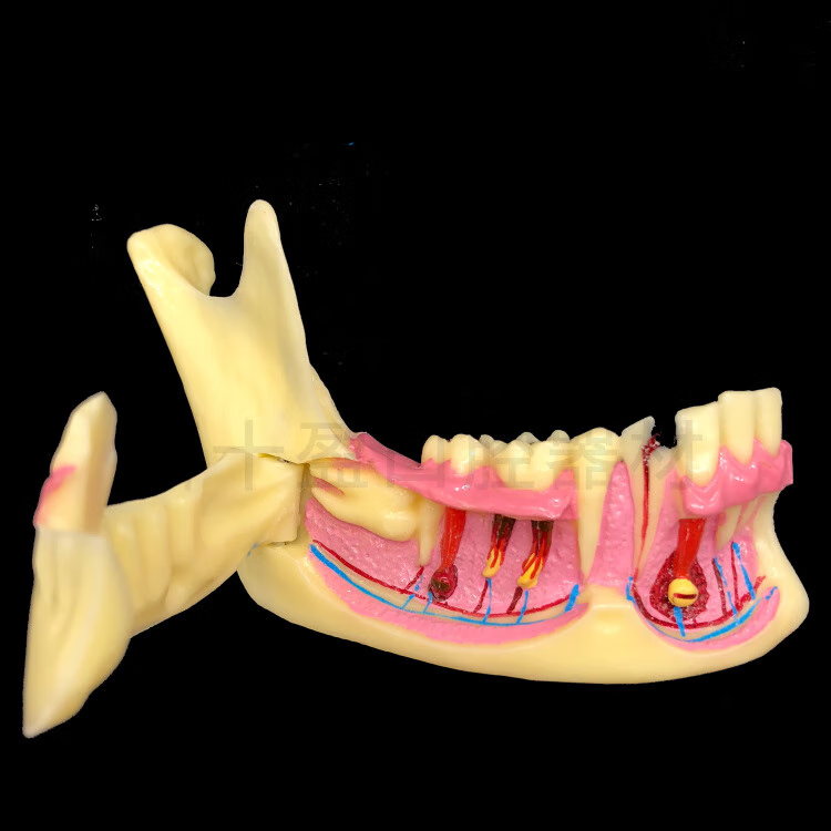 美衣羊牙科 下颌骨分解模型 牙龈下半侧可打开 牙齿结构分解解析 下颌