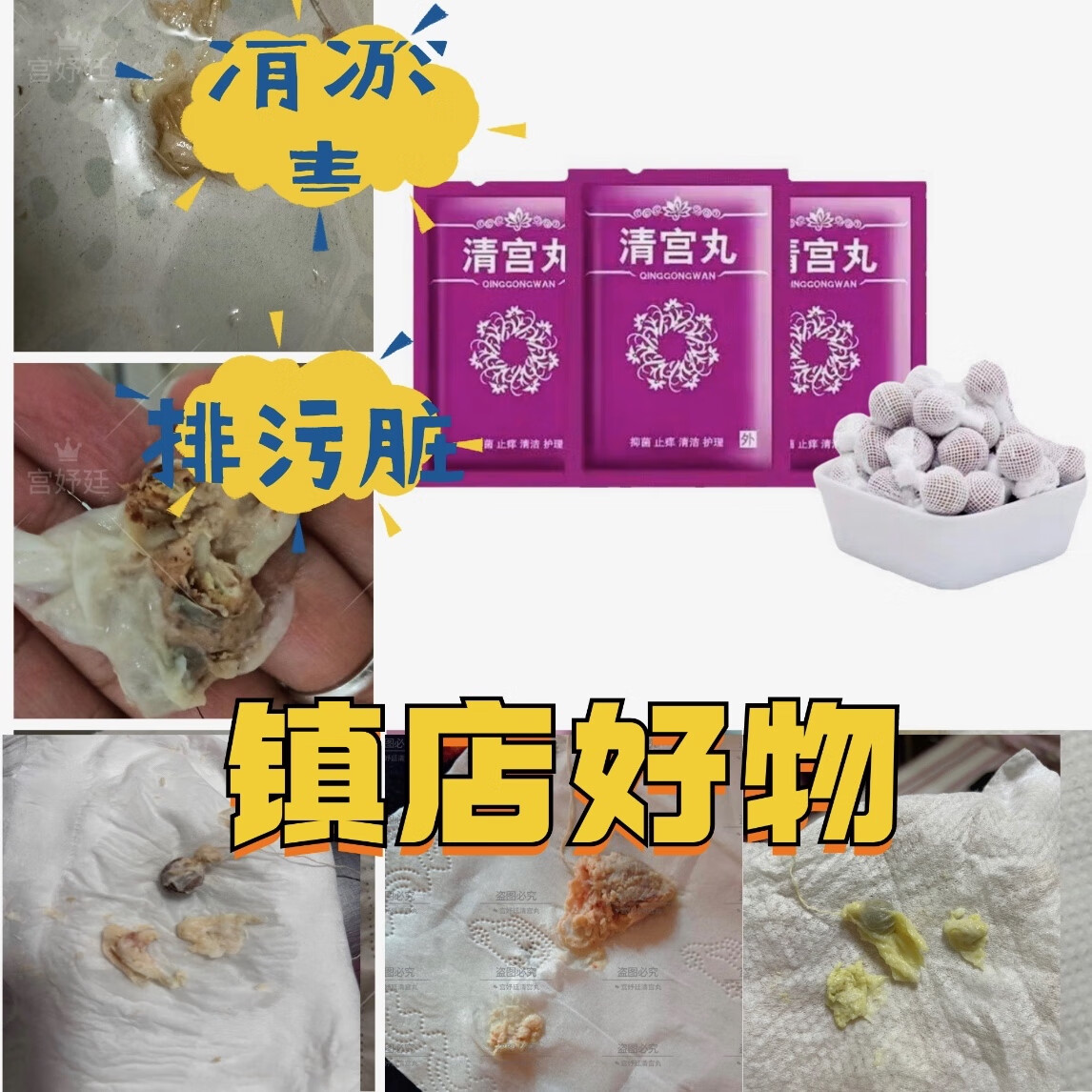 清宫丸抑菌止痒护理妇科清洁排污排脏豆腐渣霉菌
