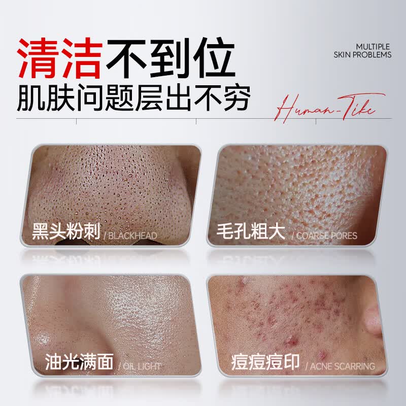 kuvive新加坡进口清洁面膜去黑头泥膜祛痘粉刺闭口涂抹式收缩毛孔男女士 【去黑头】清洁泥膜150g