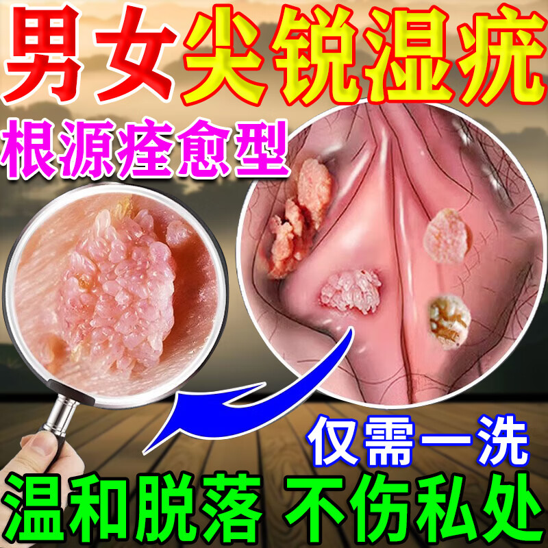 内廷上用尖锐湿疣私处专用脱落膏hpv去疣体鬼臼毒素5%软膏酊正品菜花状疣 医用特效洗液  买三送二【一次解决】 尖锐湿疣专用男性抗hpv病毒干扰素剂防复发外用