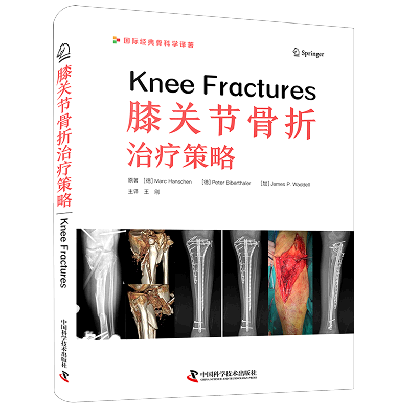 膝关节骨折治疗策略