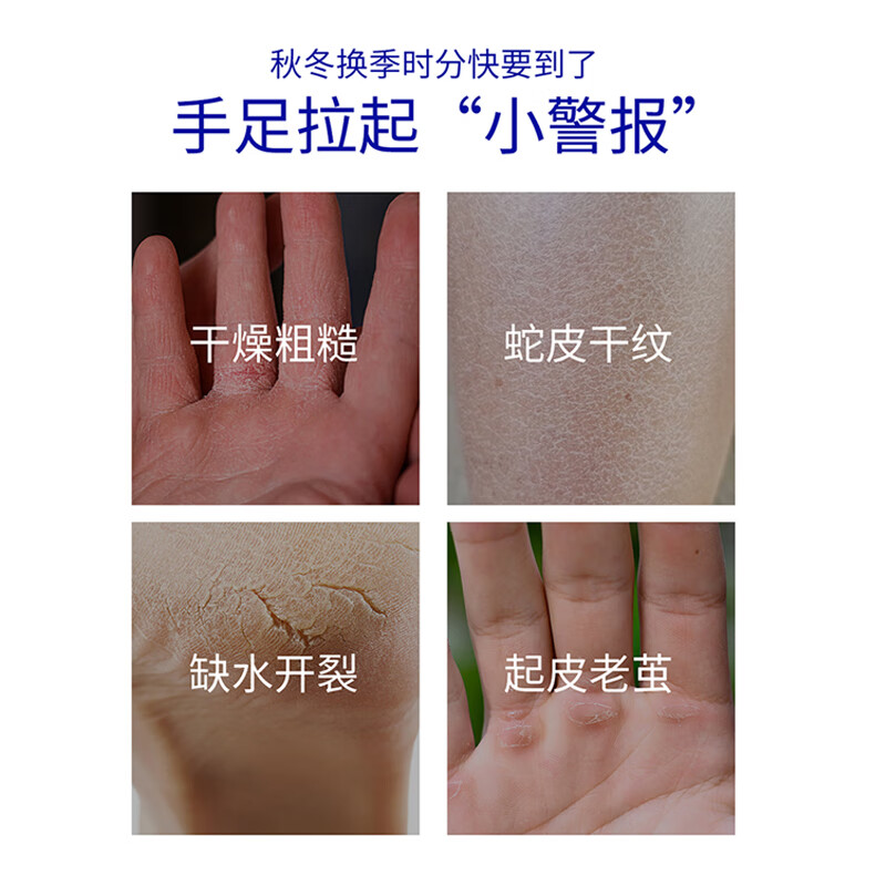 本叮叮保湿皲裂膏手足防干裂膏脚后跟干裂冻裂膏护足霜男女通用50g/瓶 【修护干裂】手足皲裂膏100g/2盒