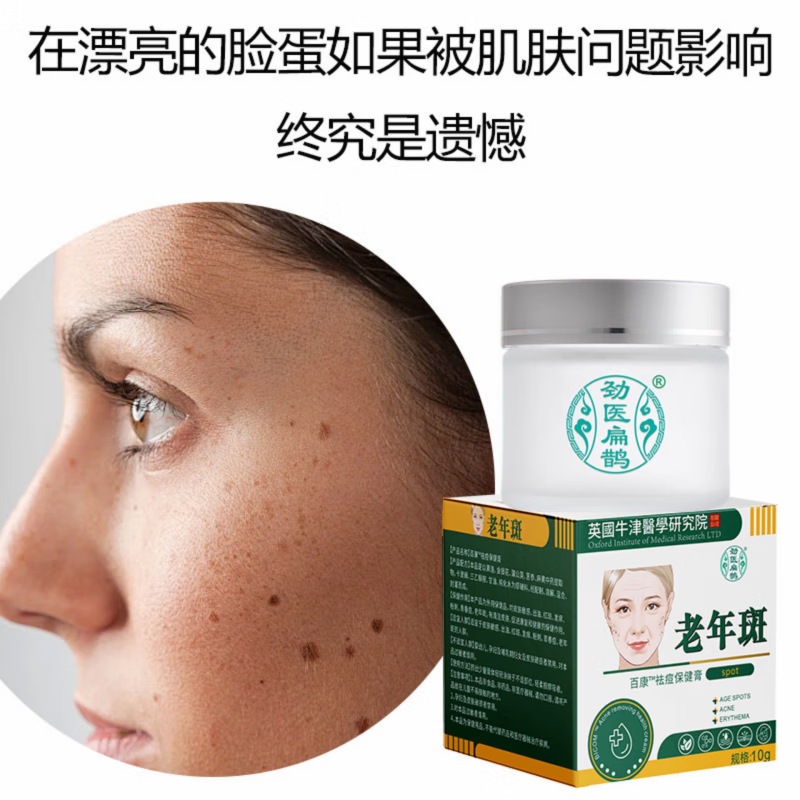 劲医扁鹊老年斑专用祛斑霜祛痘粉刺淡化黑色素雀斑黄褐斑晒斑正品 5瓶-祛斑霜祛斑黄褐斑雀斑晒斑女士用的