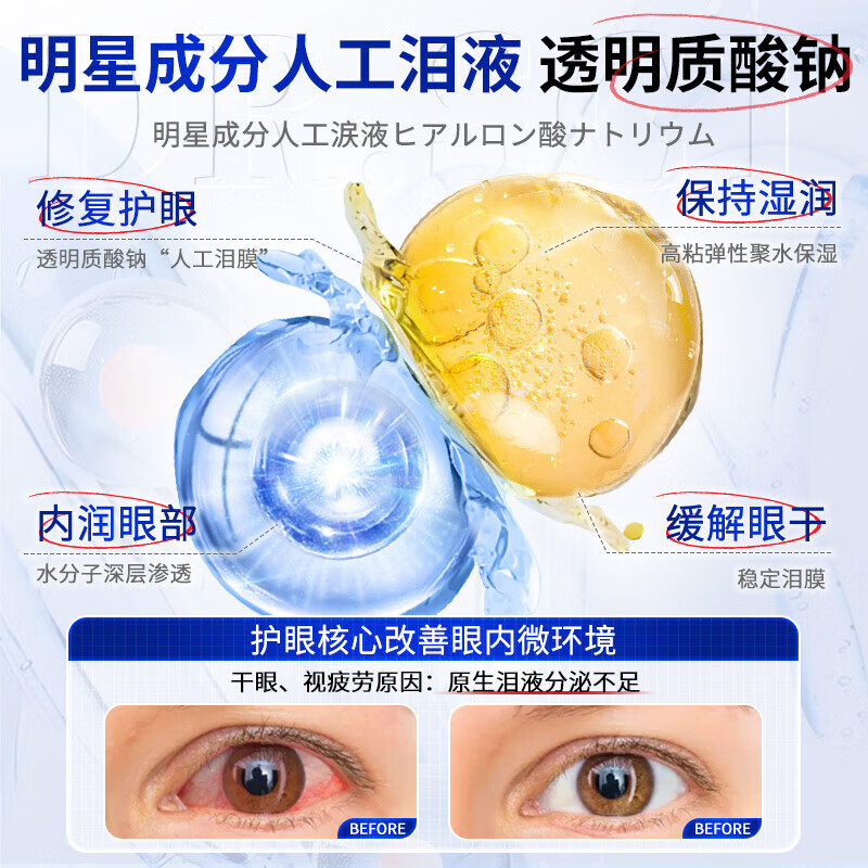 DR.SCT叶黄素滴眼液缓解眼疲劳眼干眼涩视力模糊发痒红血丝眼药水 【明目润眼】叶黄素护眼喷雾*5