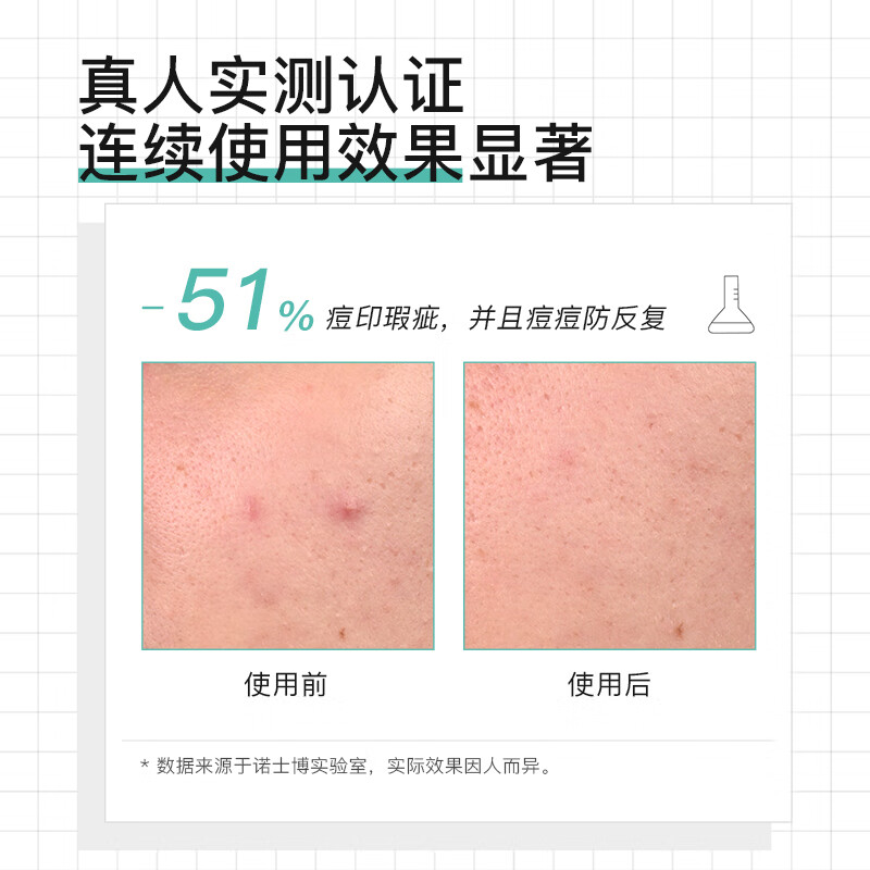 诺士博(NOVEXPERT)孕妇祛痘精华液面部控油祛痘收毛孔闭口褪红舒缓修护生日礼物30ml 【控油祛痘】诺士博夜间精华30ml×1