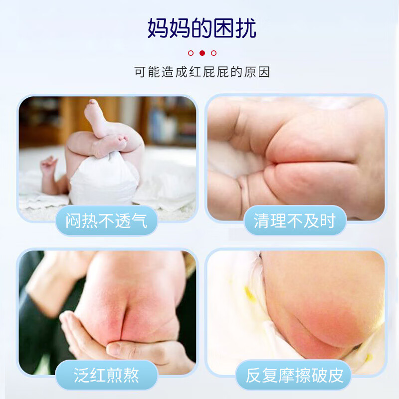 BEIYVS鞣酸抑菌软膏婴儿红屁股日本进口护臀膏宝宝乳膏柔酸红屁屁霜淹脖 二盒装