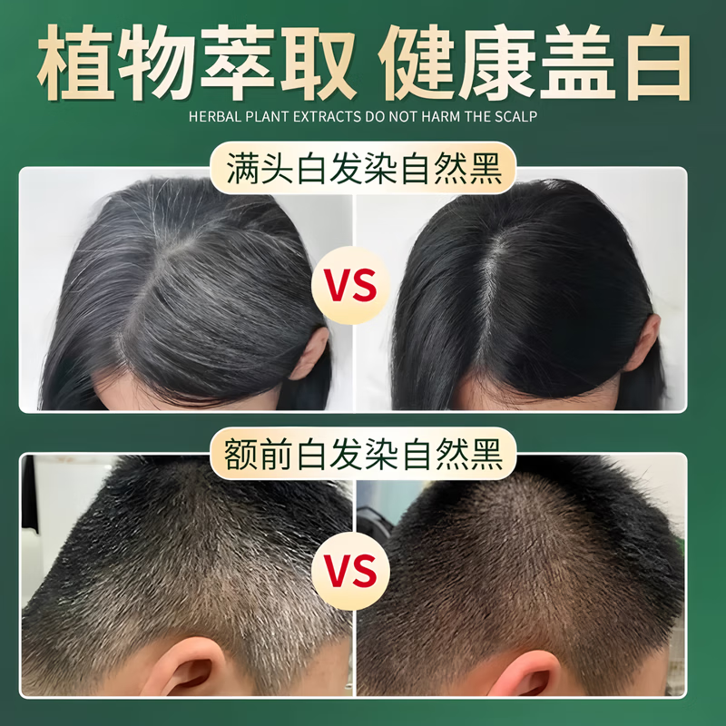 同仁堂染发膏纯天然植物无刺激不沾头皮孕妇可用一洗黑染发剂男士专用女 栗子色【健康不致癌 可盖白发】