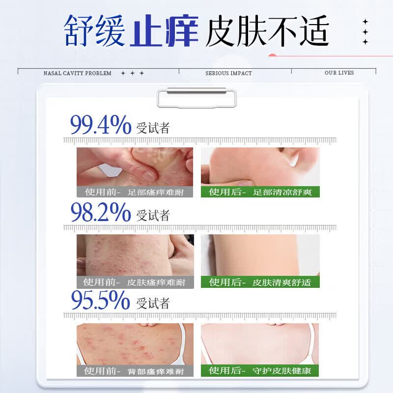 日本化藥【一抹止痒】日本特效炉甘石皮肤干痒抑菌润肤乳全身适用止痒药膏 1瓶【3秒止痒】 湿疹特效的药止痒去根