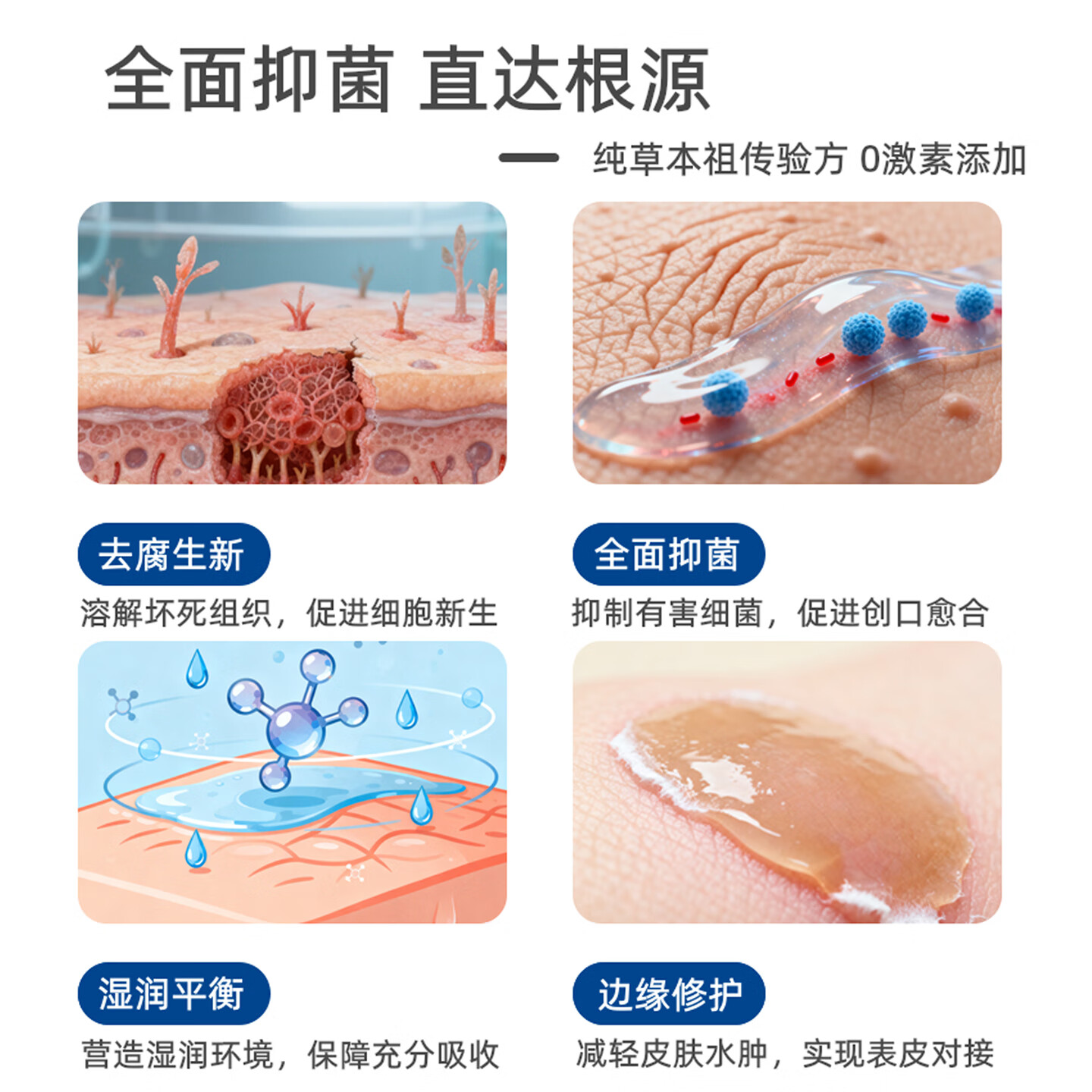 颜盾抑菌膏真菌感染草本乳膏外用软膏皮肤擦伤烫伤褥疮问题消肿止痒 一盒