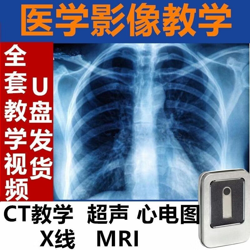 戚迹医学影像学视频u盘教学ct:mri:x线:声:心电图全套阅片课程学习
