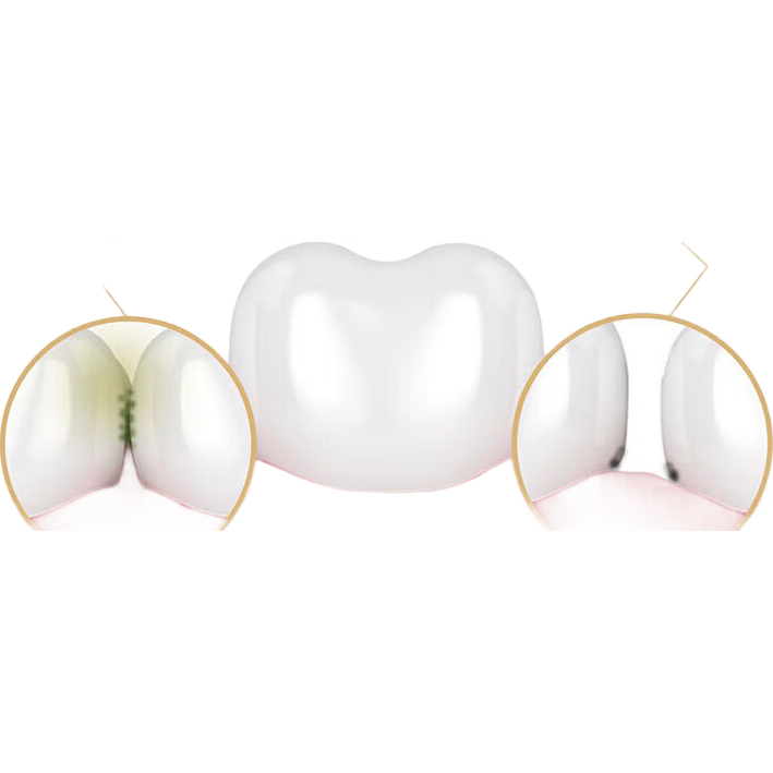 【京东物流】盒装牙线超细家庭剔牙盒装 【直播试用价】1盒50支