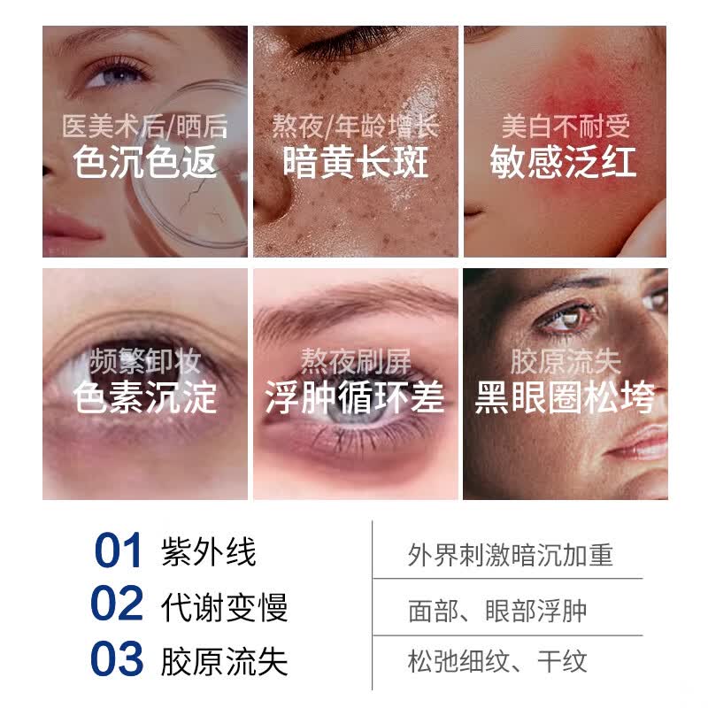 斯诺舟肝素钠乳霜黑眼圈眼霜淡化细纹提拉紧致黑眼圈眼袋眼纹去除膏 【法国院线同款】3支周期装划算