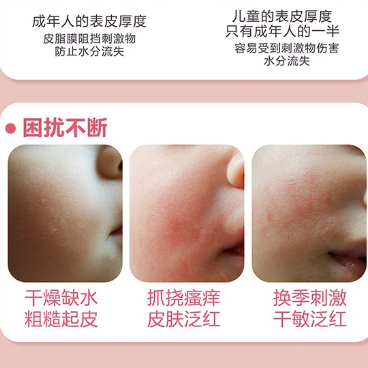 婴可思 【老配方】小绵羊油滋润霜宝宝擦脸霜儿童面霜秋冬面霜润肤霜 【超值2瓶】小绵羊油【老配方】