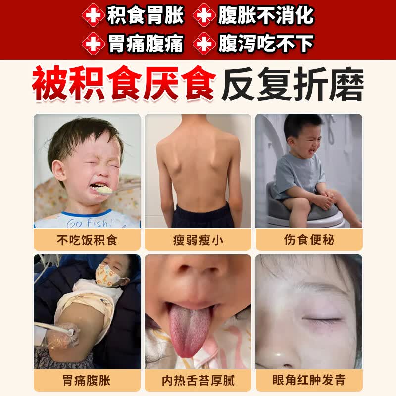 万太医远红外小儿肠胃贴积食消食化食积儿童消食健脾贴W1 5盒【周期装】多盒划算