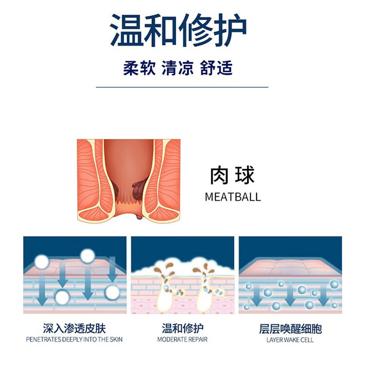 冰山【药房直售】快痔卡波姆凝胶内痔混合痔胀痛黏膜充血 3盒装