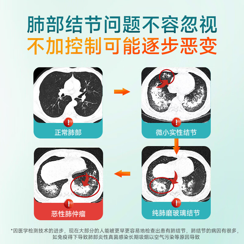 ANICo小绿条槲皮素清肺止咳化痰喘畅快呼吸养肺润肺部散结节澳洲进口 9盒巩固装【长效养护买6送3 适用10-20mm】
