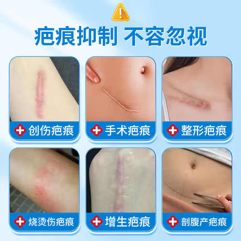 内廷上用同仁堂医用疤痕贴剖腹产手术淡化去专用修复药膏 【1盒体验装】2贴/盒