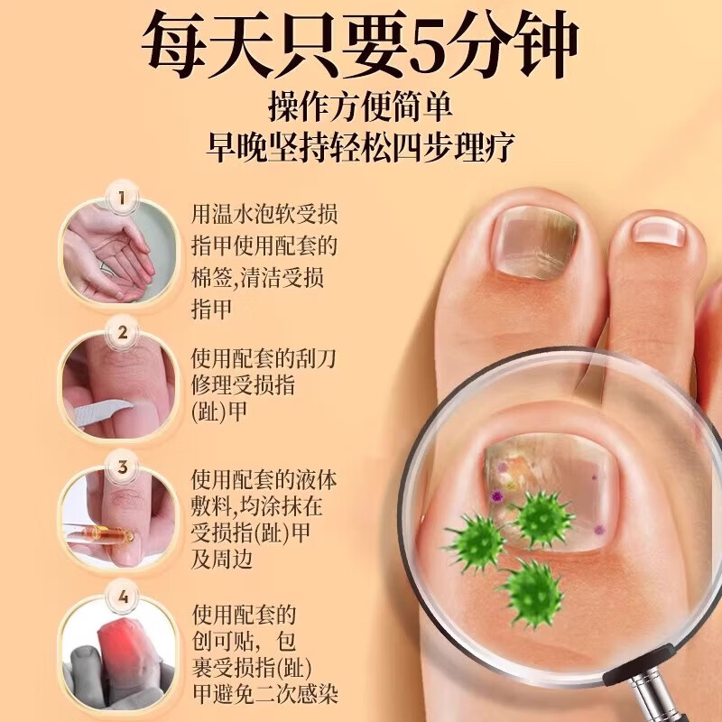 内廷上用北京同仁堂医用指甲创面护理盒改善灰指甲甲沟炎空甲指甲浑浊易碎 【1盒体验装】30g/盒