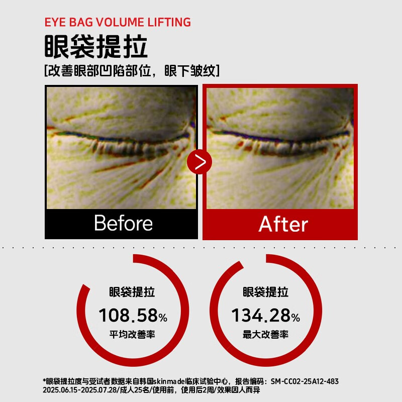 梦若羽（MRYU）MRYU高级消袋苷乳霜BEAUTYDRAMA医研眼部紧致霜微针眼霜补水保湿 1盒装【基础美白】 官方授权