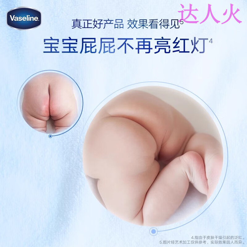 鹿角卉（LUJAHA）贝克敏宝宝霜凡士林唇周膏口水疹湿疹儿童面霜婴幼保湿霜 体验装【1瓶 】 官方直售