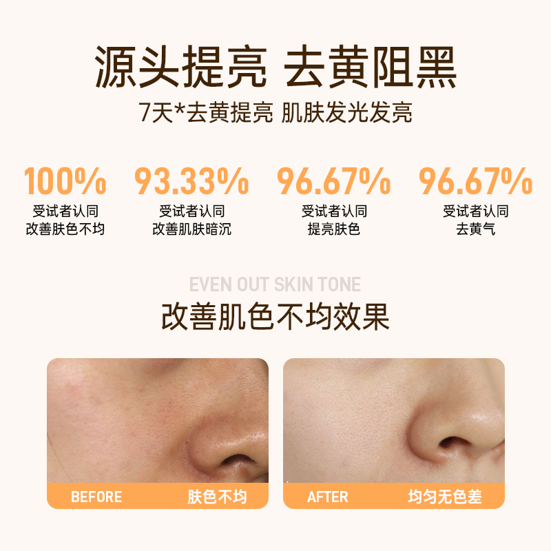 奥贝兰【颖儿同款】水乳霜套装保湿补水抗皱紧致初老焕白去黄提亮控油 【5件套】水乳+精华液+霜+湿敷水