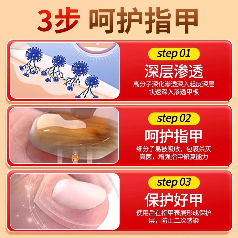 内廷上用北京同仁堂医用指甲创面护理盒改善灰指甲甲沟炎空甲指甲浑浊易碎 【1盒体验装】30g/盒