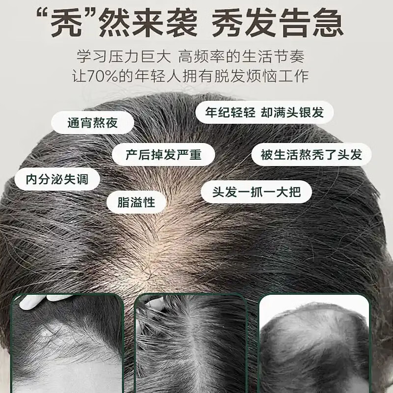 侗百谷二硫化硒洗发水控油蓬松去屑护发素止痒留香修护毛躁龙脑液沐浴露 控油去屑】龙脑香氛洗发水500ml