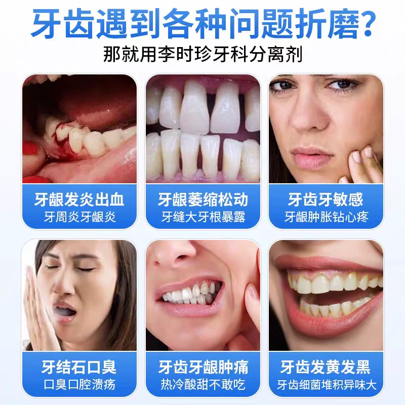 李时珍溢口宁医用口腔防蛀膏再生硅修护龋齿烂牙蛀牙固齿全家老少可用 10盒【家庭装】守护家庭健康 【120g/支】正品保证