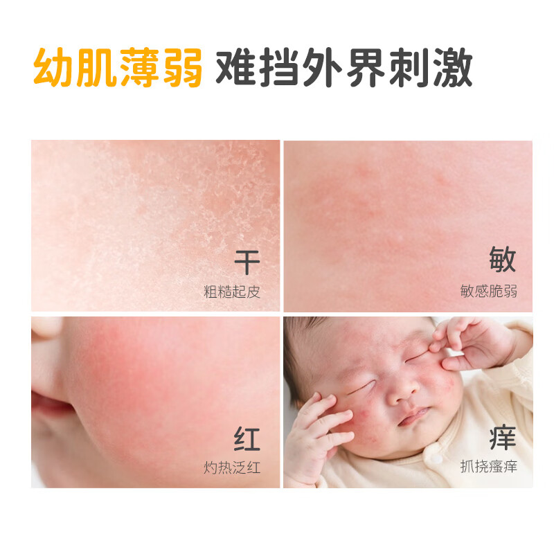 蓓雀儿宝宝润肤霜保湿补水滋润儿童新生婴儿面霜面部擦脸全身可用 【应急舒缓红点】85%客户优选精华霜100g