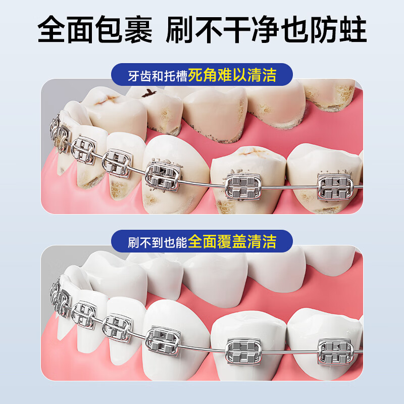 恐龙医生正畸含氟牙膏防蛀美白去牙渍牙黄清新口气护龈亮白牙膏成人 【护牙搭档】海洋薄荷110g+牙刷