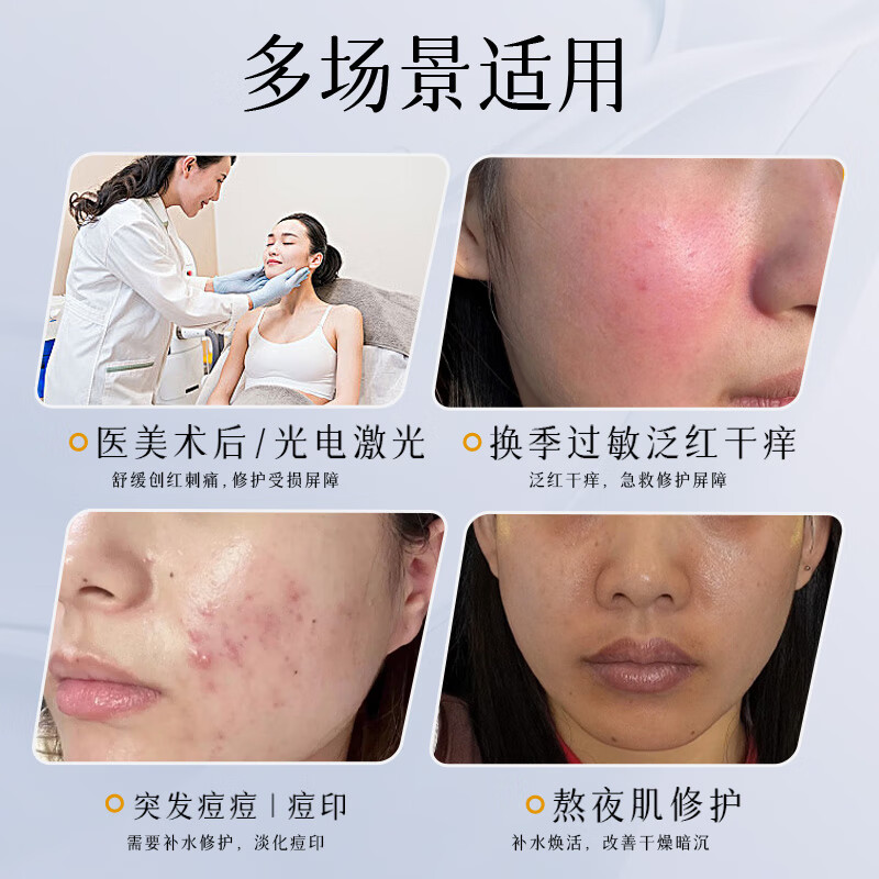 罗肤医用透明质酸钠创面敷贴补水保湿医美术后修复伤口敷料敏感泛红 1盒+1片试用（到手6片）