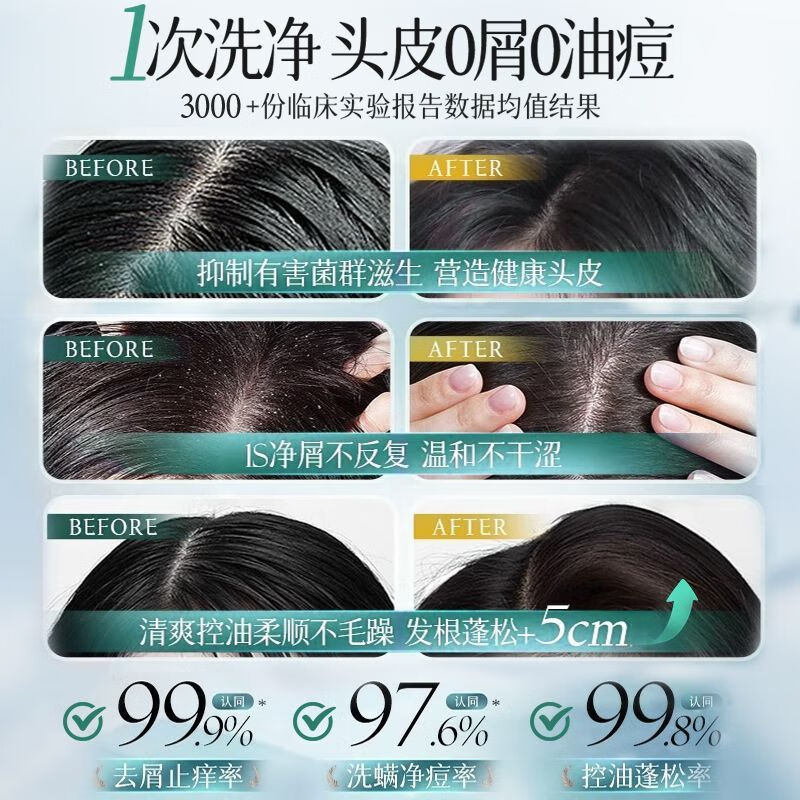 儒意氨基酸控油蓬松洗发水去屑止痒深层清洁柔顺留香新年礼物 【水杨酸控油蓬松】北国雪松洗发水800ml