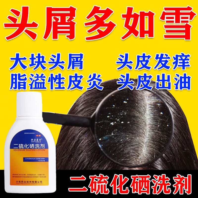 脂溢性皮炎洗发水二硫化硒洗剂头皮屑用的药洗发水去屑药真菌感染治花斑癣药汗斑脂溢性皮炎用药 1瓶【0激素 去头屑头皮油脂】