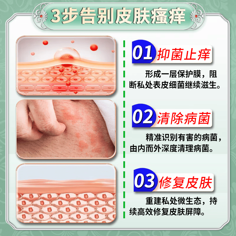 北京协和医学院止痒抑菌皮肤瘙痒身体痒止痒100%特效湿炎真菌感染皮疹过敏不反复 一盒【日本止痒喷药】 湿炎皮疹不反复 .