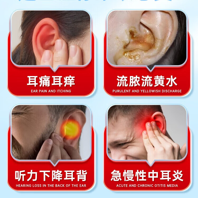 内廷上用同仁堂耳耵聍清洗器耳鸣耳痒耳道发炎流脓耳钉中耳炎液软化洗液 【1盒体验装】20ml/瓶