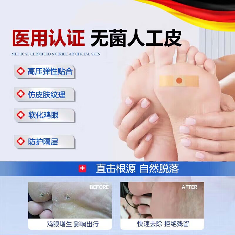 保中寳鸡眼膏贴去脚跟鸡眼膏贴去肉根刺刺猴无.痛脱落连根.拔鸡眼去除药 特效：1盒【鸡眼专用】