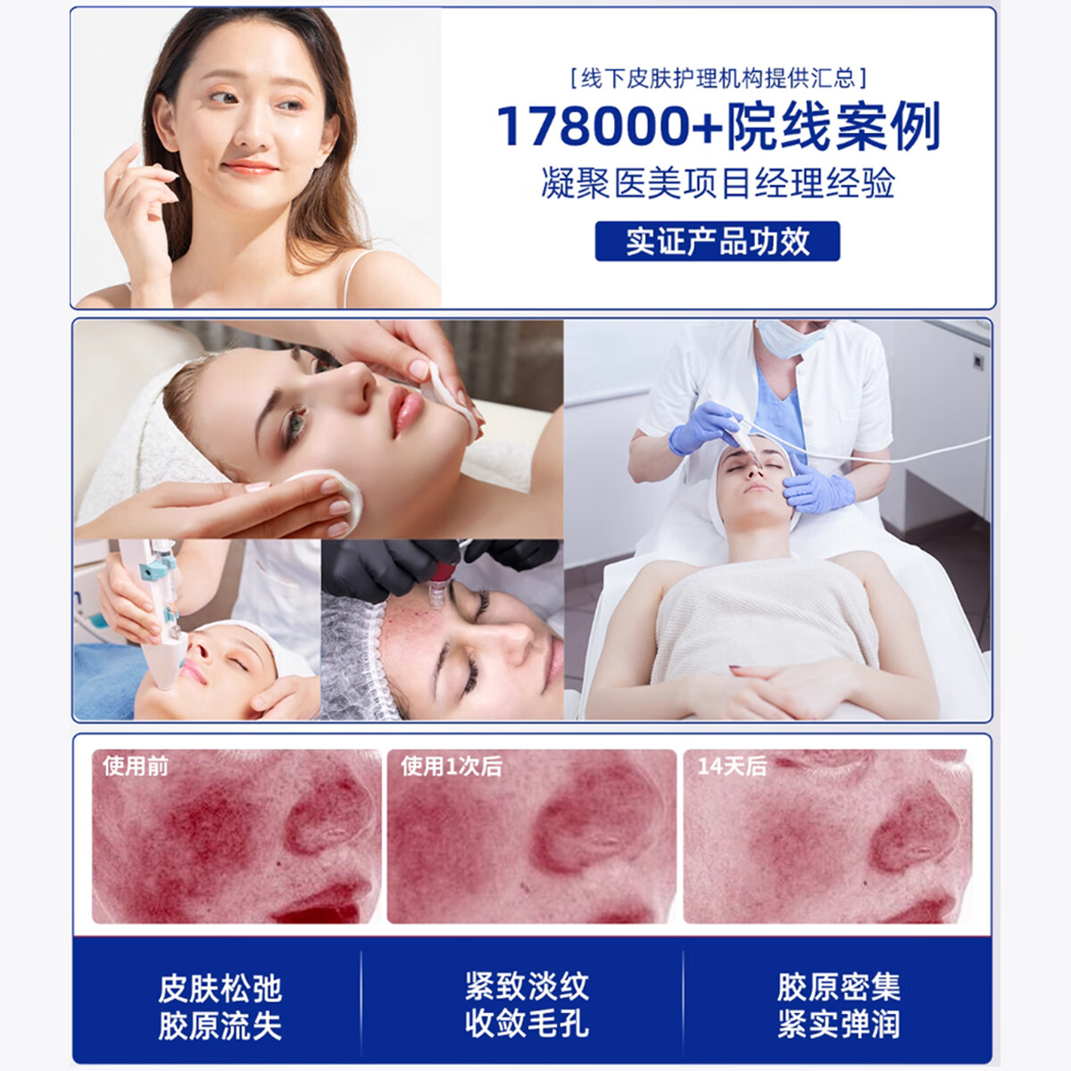 葵花医用重组三型人源化胶原蛋白修护凝胶抬头法令纹口角囊袋修复专用 五盒装【告别细纹 皮肤细腻18岁】