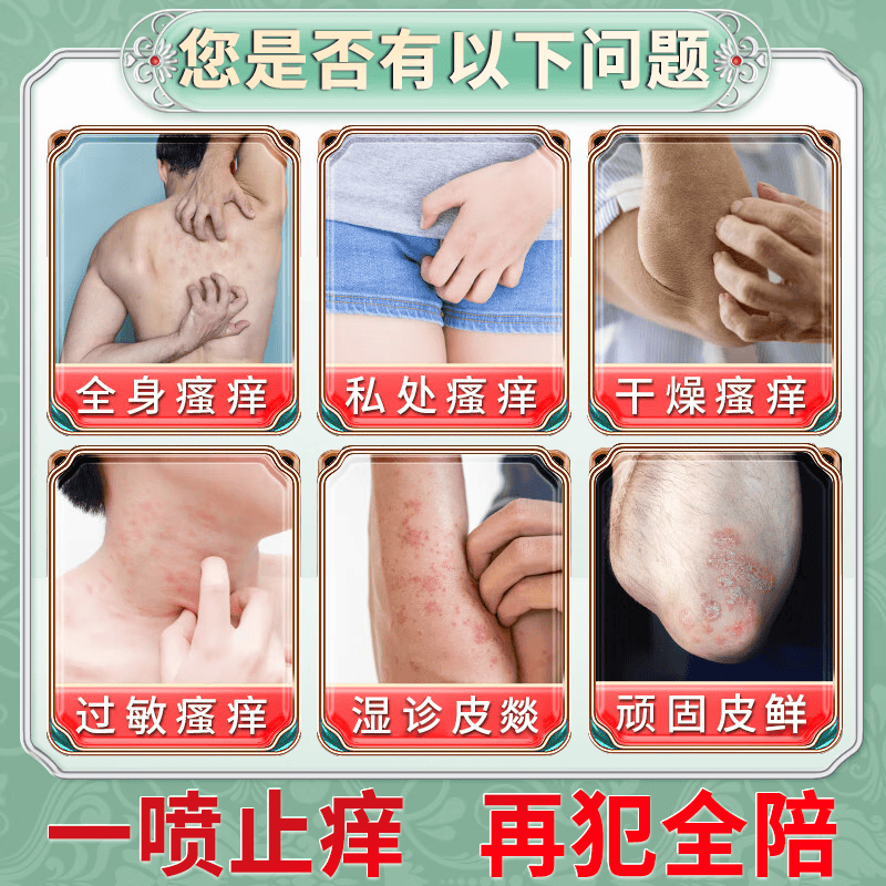 北京协和医学院止痒抑菌皮肤瘙痒身体痒止痒100%特效湿炎真菌感染皮疹过敏不反复 一盒【日本止痒喷药】 湿炎皮疹不反复 .