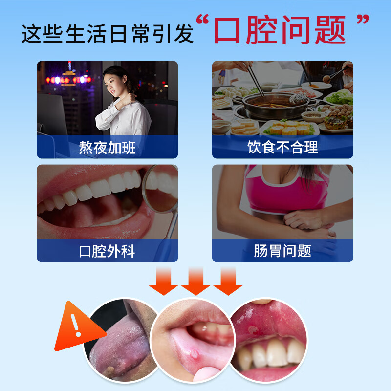 牙得安一点灵正品上火口腔不适口腔黏膜凉茶铺起泡送涂抹棒100支+牙粉 1.5m防伪一点灵+涂抹棒+牙粉五小包